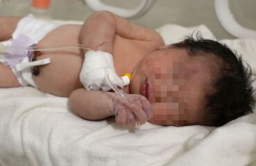 Miracolo in Siria: neonata trovata viva sotto le macerie del terremoto con ancora il cordone ombelicale