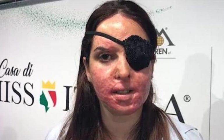 Condannato a 15 anni l’ex di Gessica Notaro: la sfregiò in volto con l’acido
