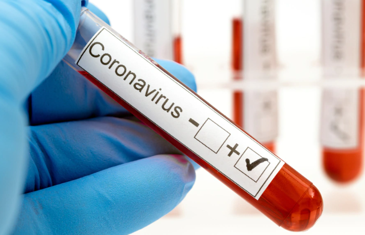 coronavirus-test