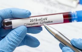 test-sierologici-coronavirus-