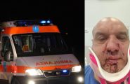 Spacca il naso a un soccorritore perché l’ambulanza ostacola l’ingresso in discoteca: condannato a 10 mesi di carcere