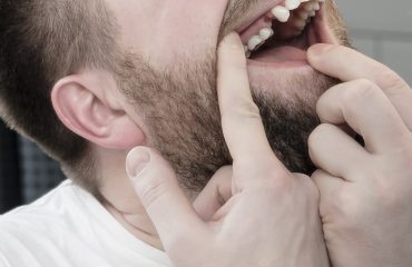 Upset young Caucasian man with a beard opened mouth and carefull
