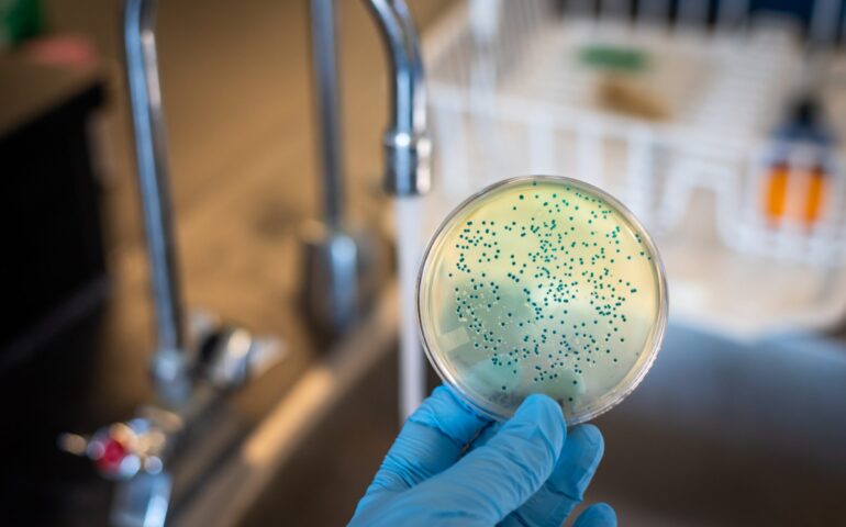 colera-escherichia-coli
