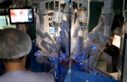Realizzato in Sardegna il primo intervento di chirurgia pediatrica robotica: il piccolo paziente ha 8 anni