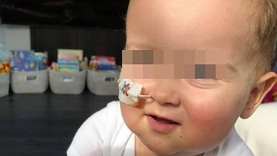 Il trapianto del piccolo Alex è riuscito: il bambino sta per essere dimesso