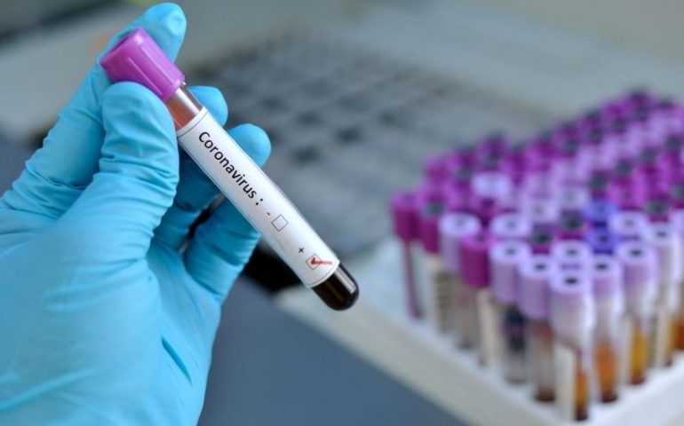 Coronavirus: positivi ai test due cittadini di Quartu Sant’Elena