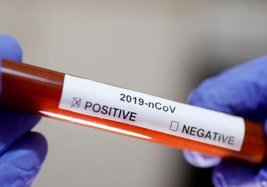 Covid-19. La Diasorin entro marzo lancerà il test con responso in 60 minuti