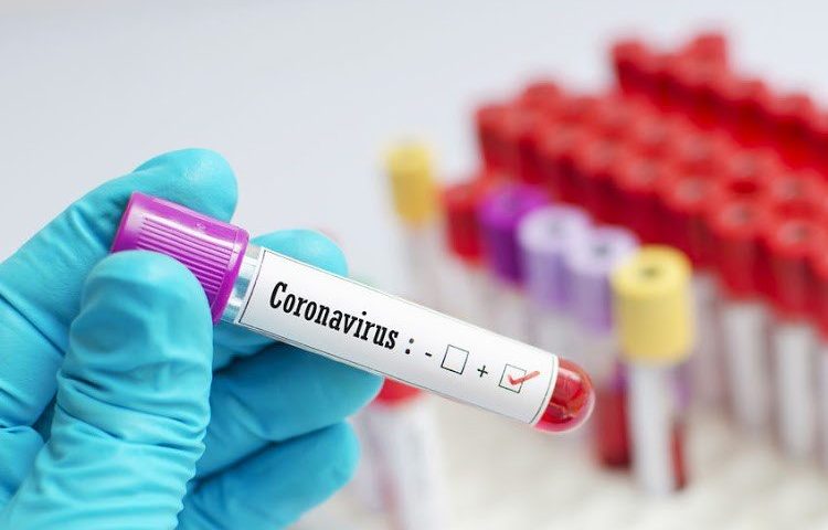 Covid-19, oggi si registrano tre nuovi casi di contagio in Sardegna