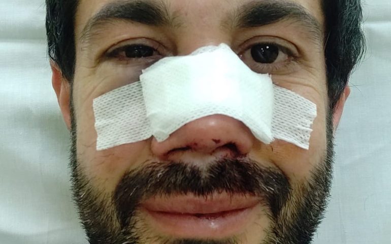 Violento pestaggio del ciclista a Tortolì. Colpo di scena, un 22enne confessa le sue responsabilità