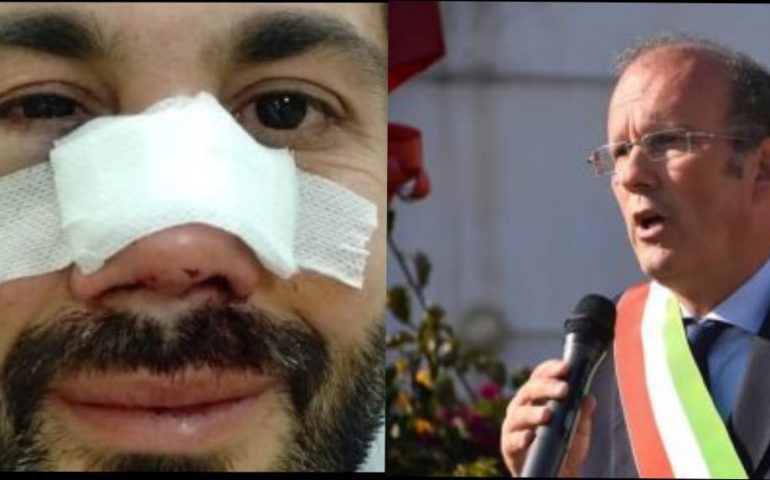 Aggressione A Tortoli Cannas Ringrazio Le Autorita Ogliastra Vistanet