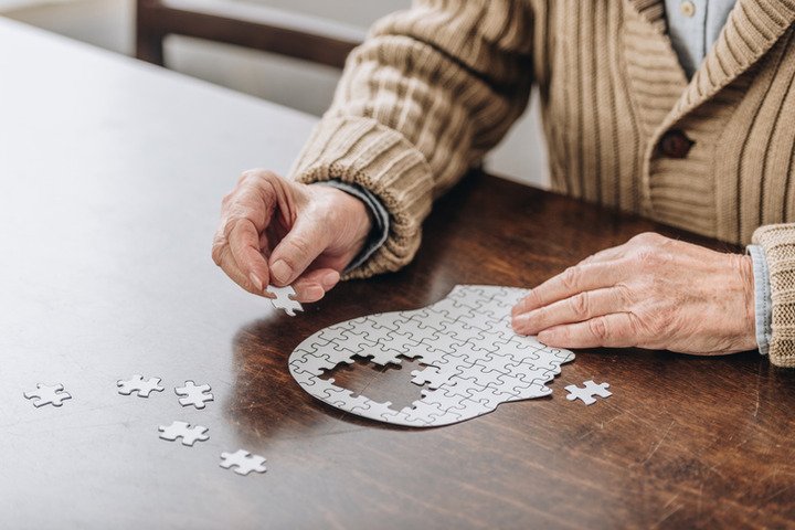 Alzheimer, finalmente primo farmaco approvato dopo 20 anni: risultato storico