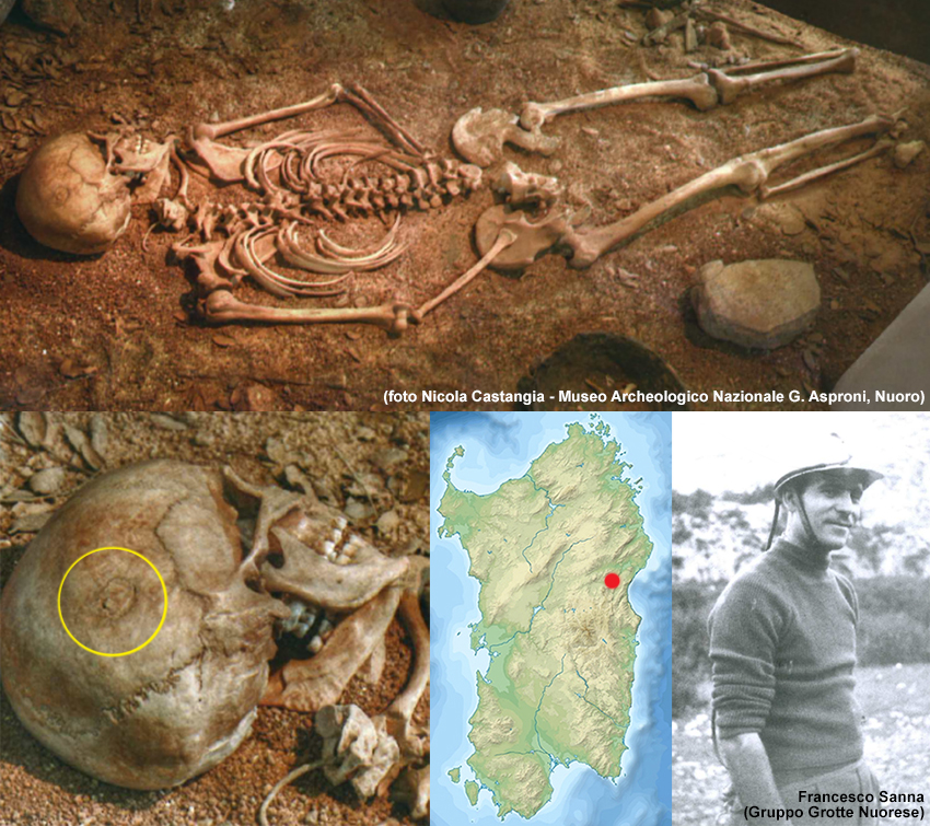 scheletro ritrovato a nuoro di 4000 anni fa