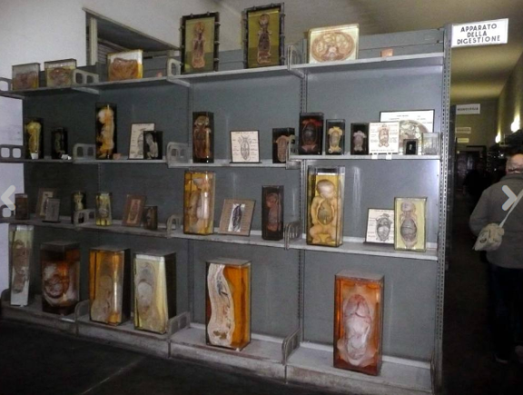 Lo sapevate? A Roma c’è un museo di anatomia umana unico in Europa con veri corpi sotto formaldeide