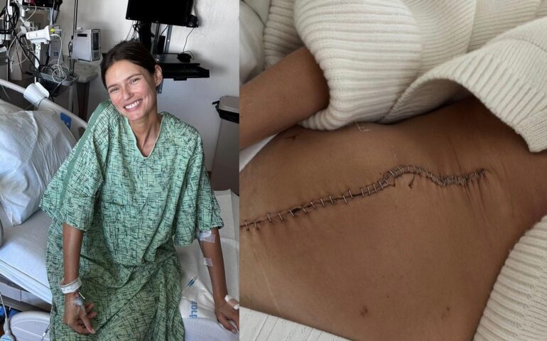 Bianca Balti mostra la cicatrice dopo l’operazione per la rimozione del cancro alle ovaie: «Mi aspetta un lungo viaggio»