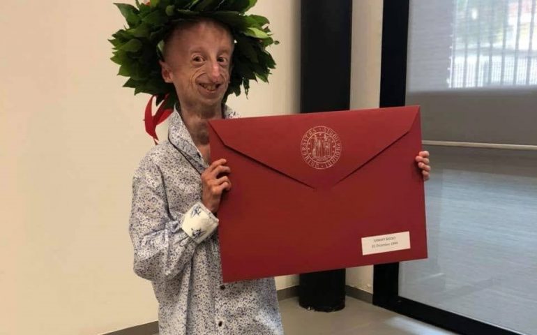 Sammy Basso, il 22enne affetto da progeria si è laureato con 110 e lode in Scienze Naturali