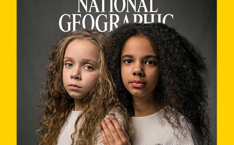 Sul National Geographic la storia delle gemelline Marcia e Millie, una nera e l’altra bionda