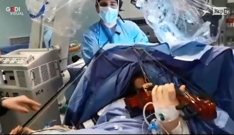 Operazione incredibile a Taranto: suona il violino mentre viene operata al cervello