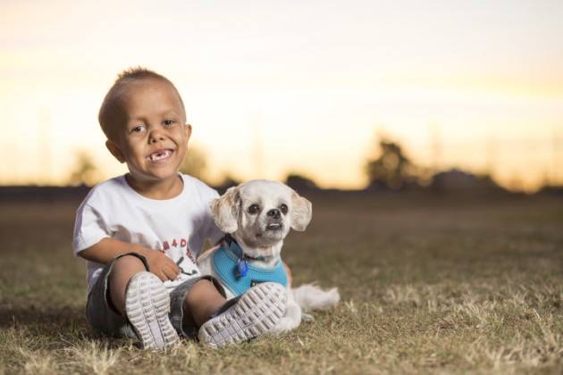 Australia: Quaden, 9 anni, bullizzato dai compagni, dice alla mamma che non vuole più vivere