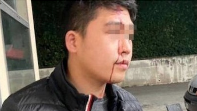 Panico da Coronavirus, giovane di origini cinesi aggredito: «Mi hanno spaccato una bottiglia in faccia»