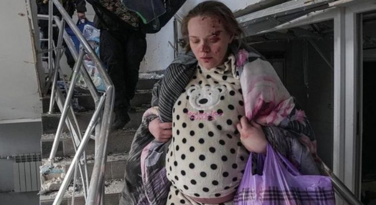 Ucraina, ha partorito la donna simbolo dell’ospedale pediatrico bombardato