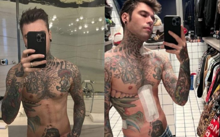 Fedez: “Ho perso 10 kg dopo l’operazione. Non vedo l’ora di salire sul palco”